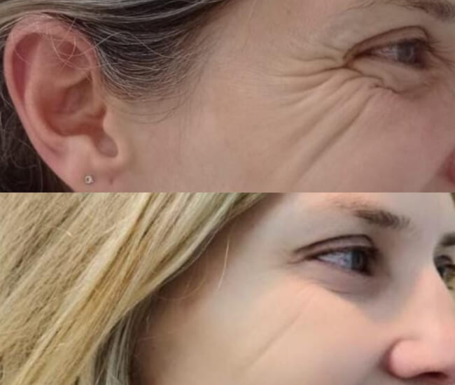 Harmonização Orofacial Santo André