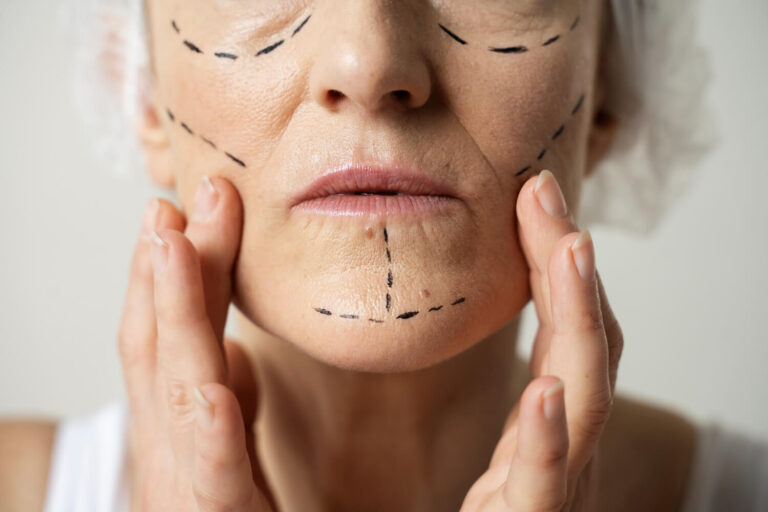 Harmonização Facial