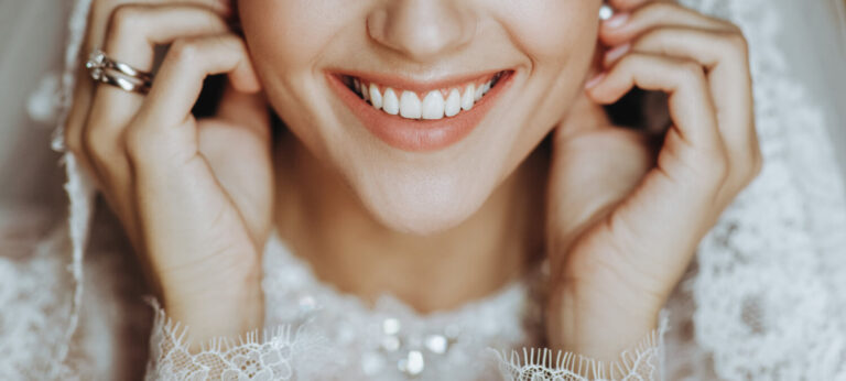 Clareamento Dental em Santo André