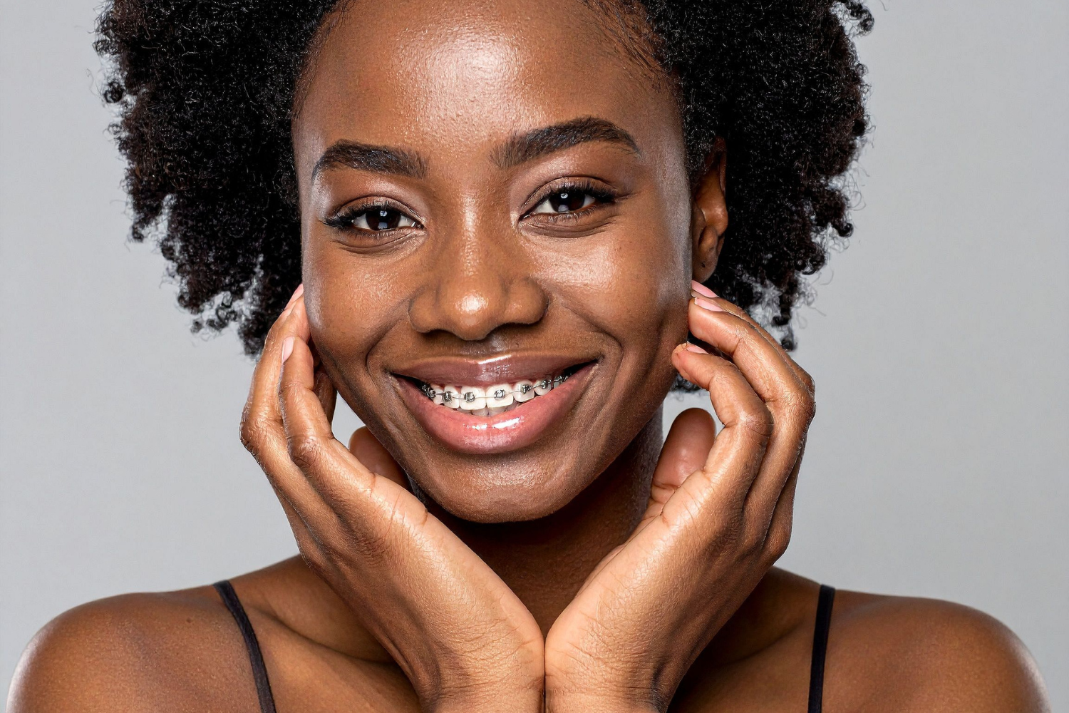 Aparelho Ortodôntico Atrapalha Beijar