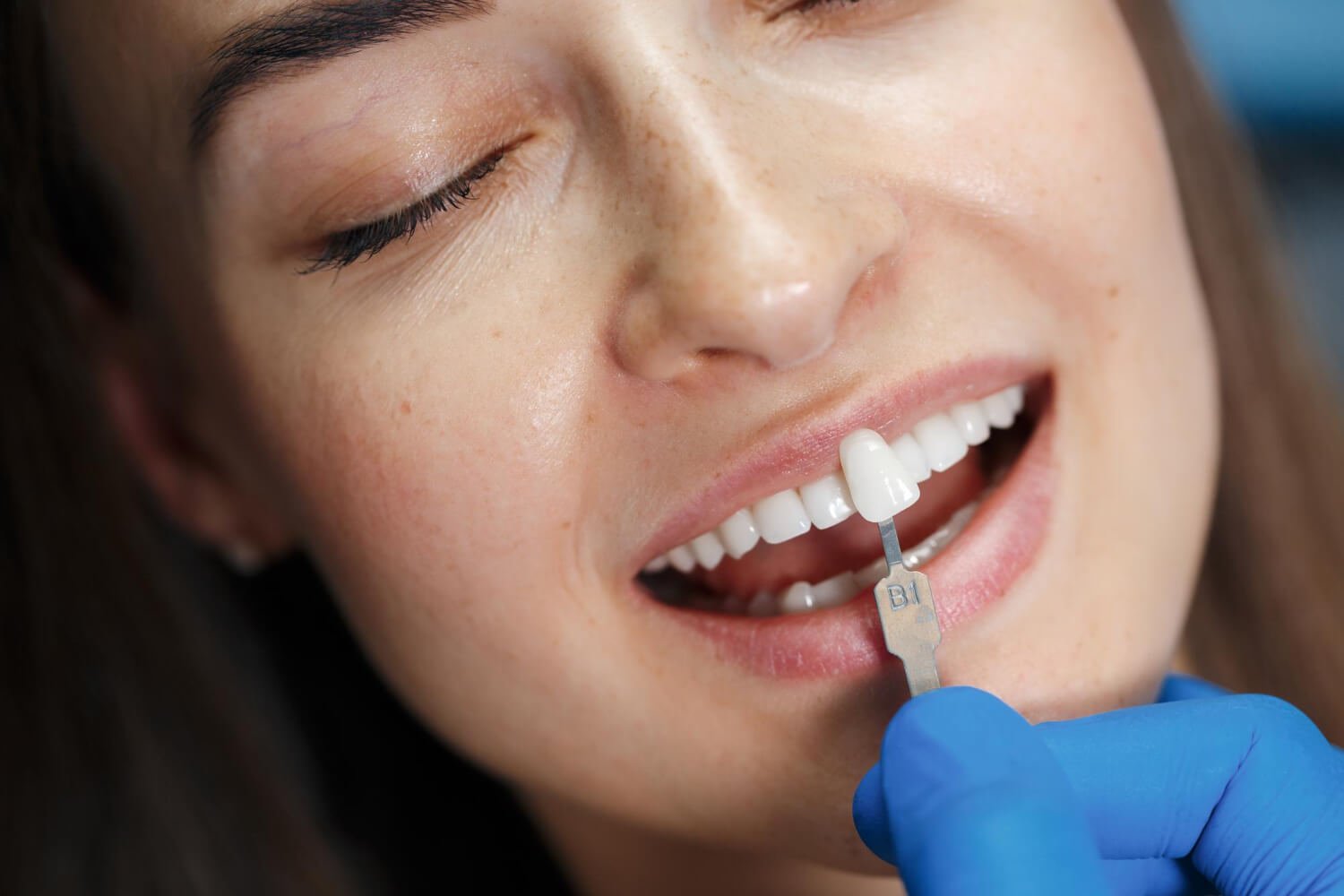 Dentista comparando a cor do dente da paciente com amostra para garantir a estética do implante de cerâmica na Clínica Adachi em Santo André.